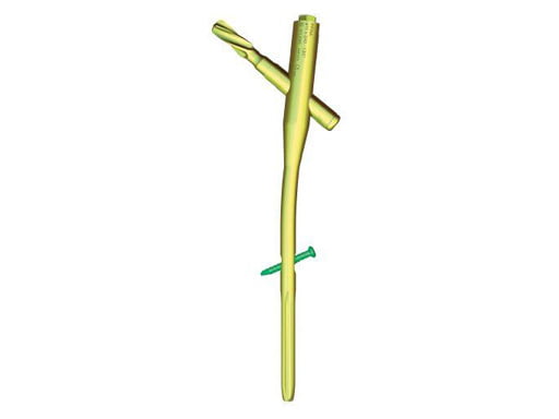 SHORT -PROXIMAL FEMORAL ROTATIONAL STABILITY NAIL(PFRN)