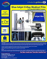 A4 x100 GoColor Inkjet Medical Blue Film for X Ray Film / SIZE: 210mm x 297mm 100 Sheet Pack of 280 GSM / 210 Micron A4 x100 GoColor Inkjet Medical Blue Film for X Ray Film / SIZE: 210mm x 297mm 100 Sheet Pack of 280 GSM / 210 Micron