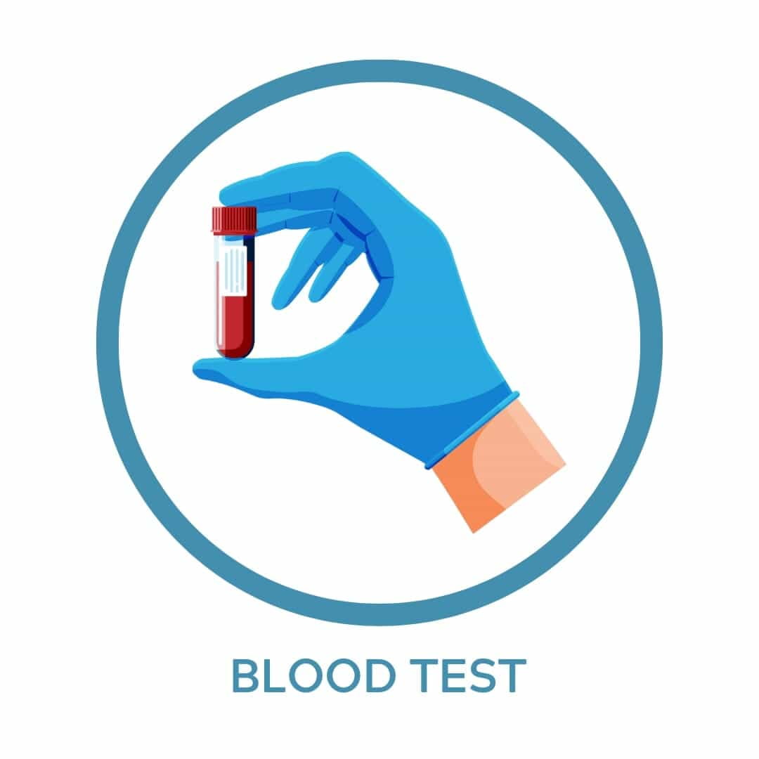 KFT ( Kidney Function Test) KFT ( Kidney Function Test)