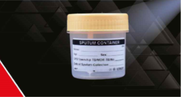 Sputum Container Sterile