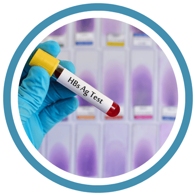 Hepatitis B Surface Antigen Test Hepatitis B Surface Antigen Test