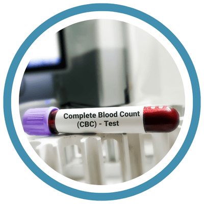 CBC (COMPLETE BLOOD COUNT) CBC (COMPLETE BLOOD COUNT)
